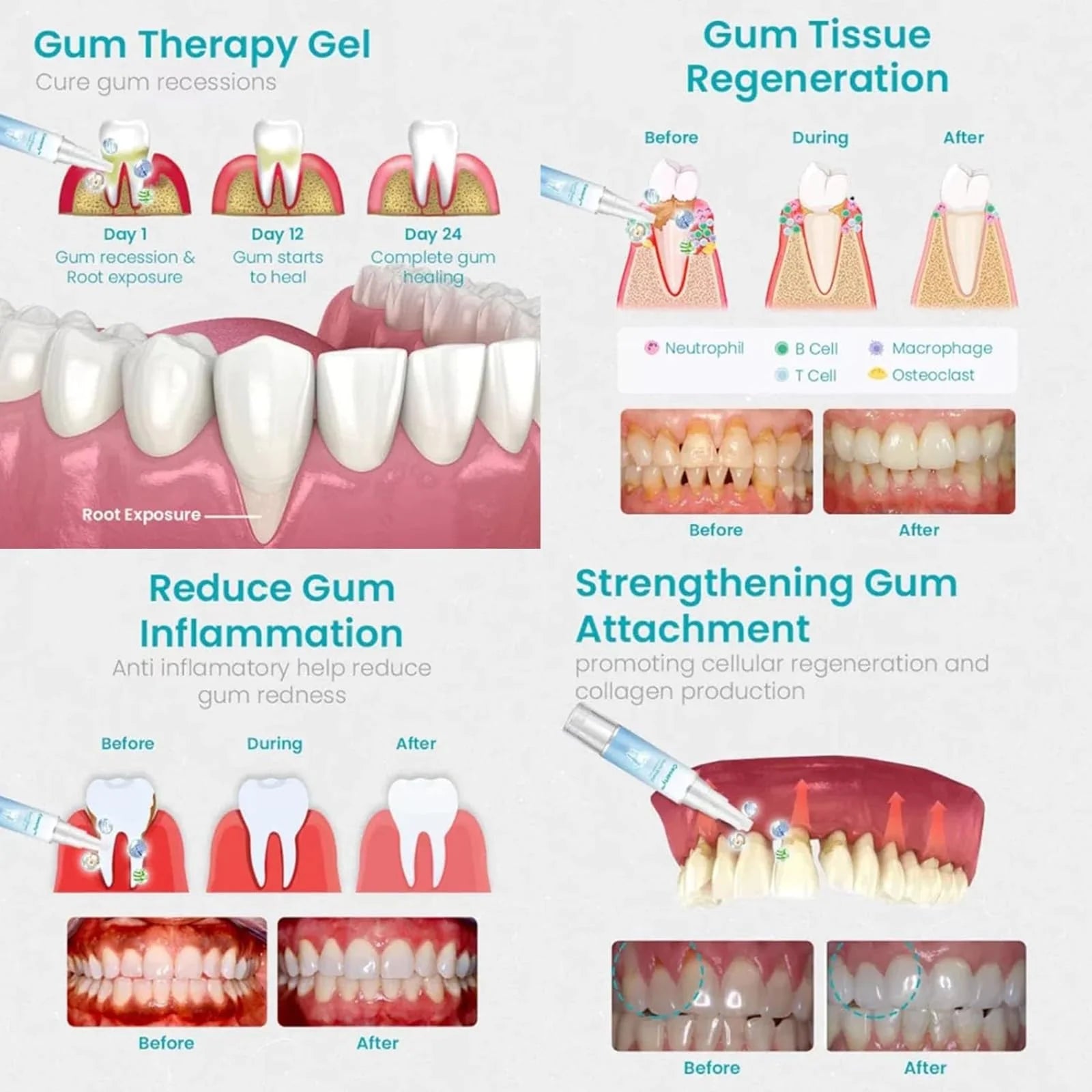 Minus™ Gum Repair Gel